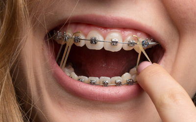 elastics1
