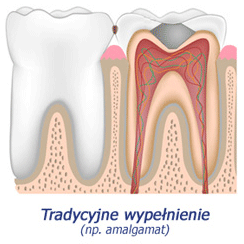 tradycyjne wypełnienie