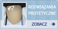 Protetyka