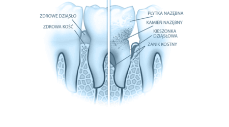 Periodontolog